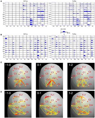 The Influence of Volume Conduction on DTF Estimate and the Problem of Its Mitigation